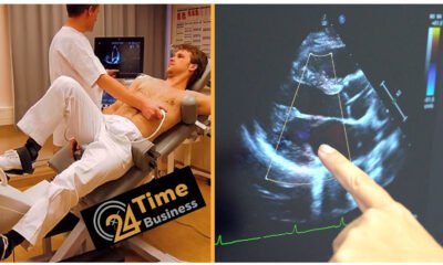 Echocardiogram Costs