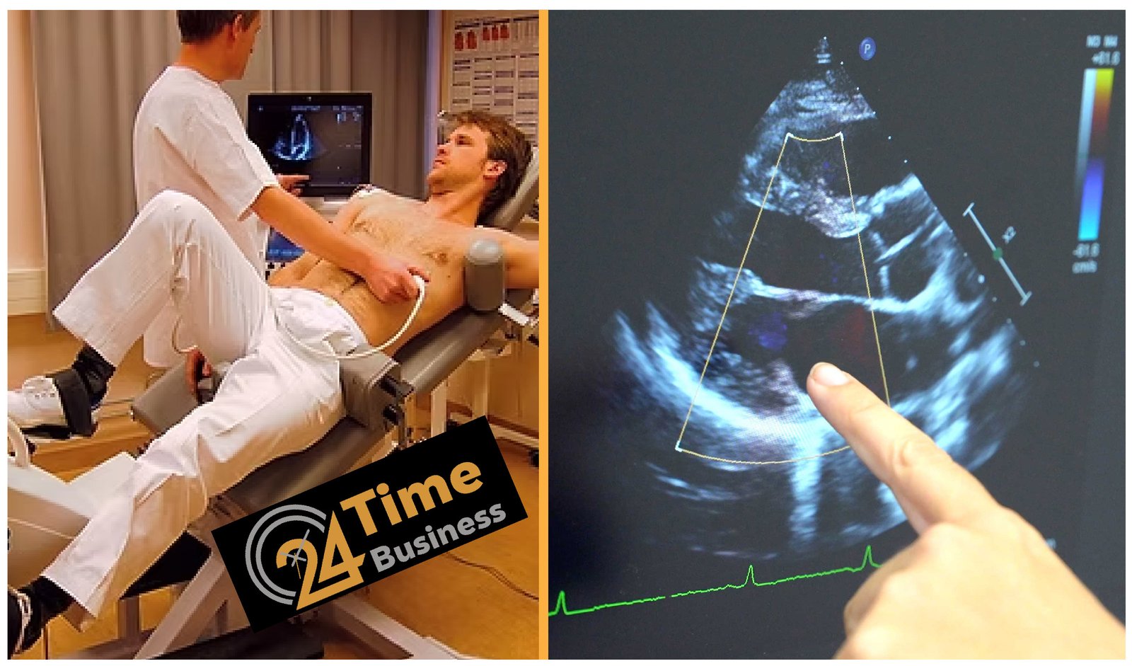 Echocardiogram Costs