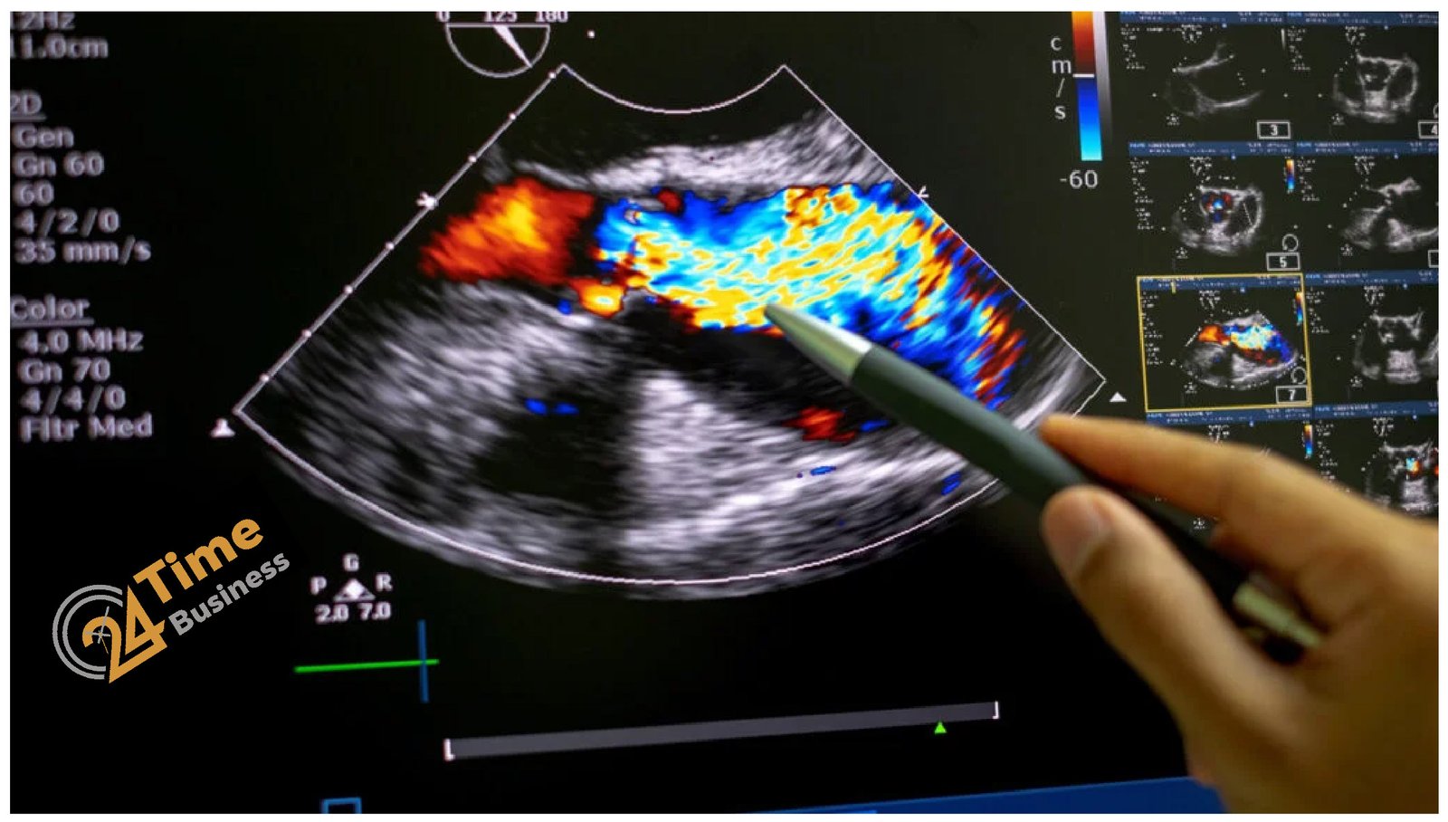 Echocardiogram Costs